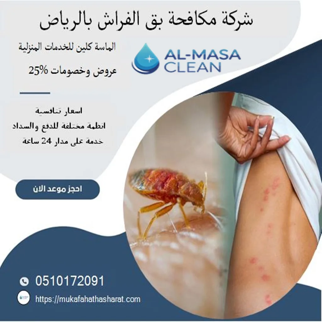 شركة بق الفراش بالرياض | 0510172091
